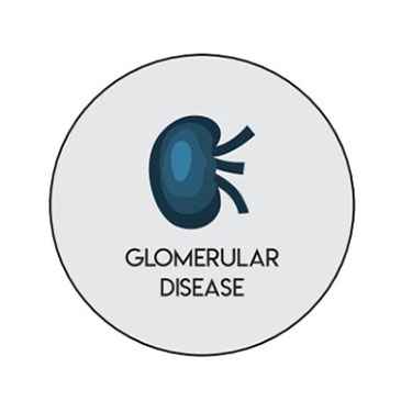 glomerular treatment